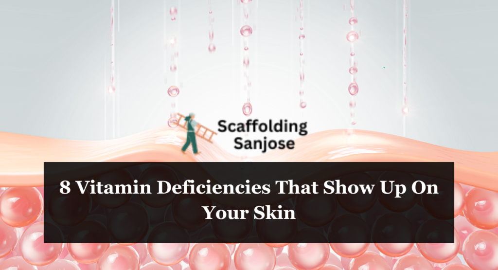 8 Vitamin Deficiencies That Show Up On Your Skin